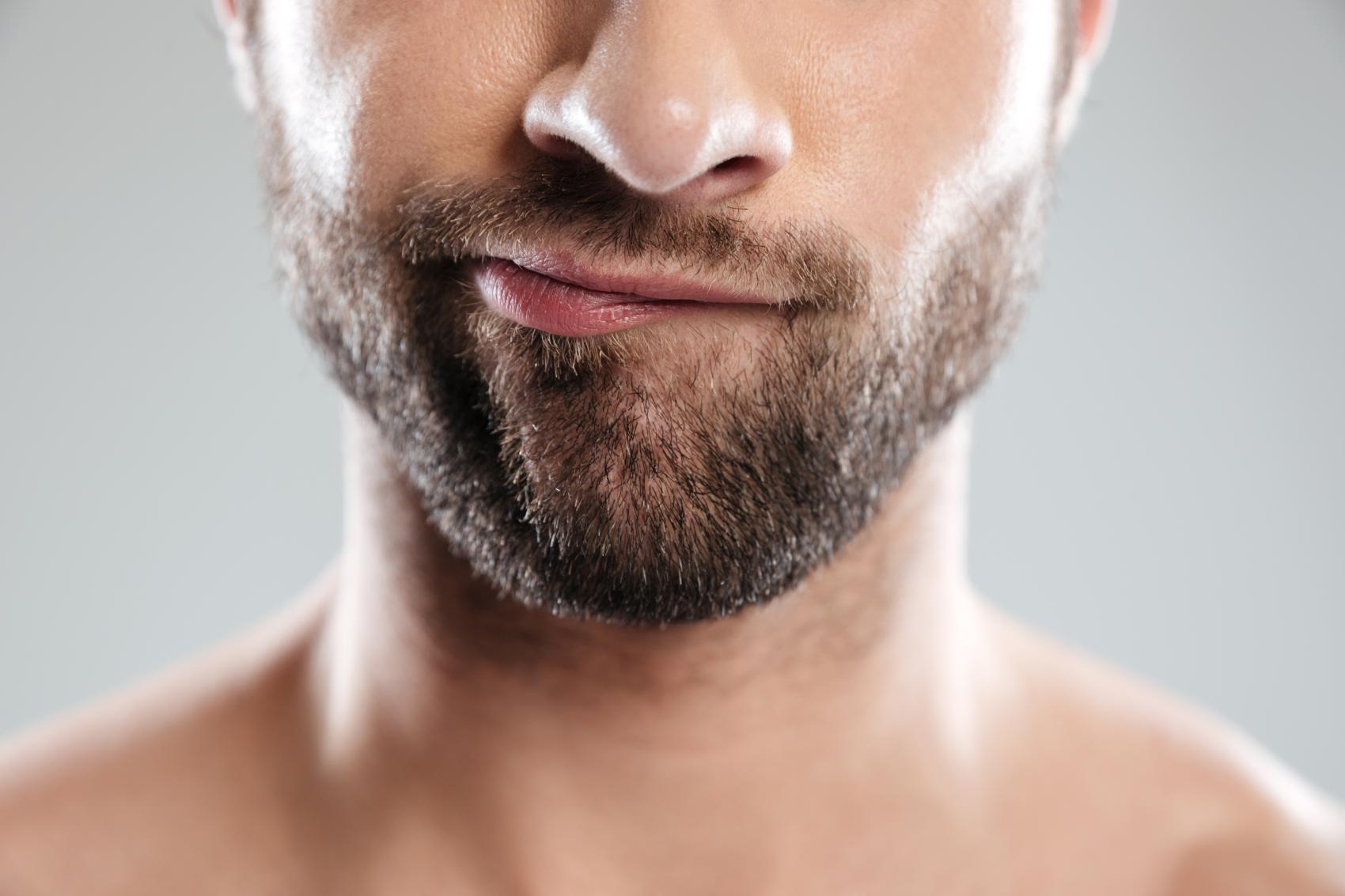 ¿Inflamacion de la piel de tu barba con perdida de vello asociada?