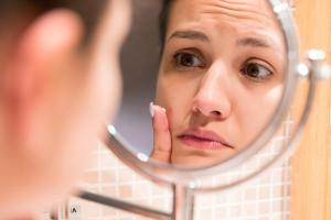 Tratamientos efectivos para eliminar el acné y sus marcas: Descubre tus opciones